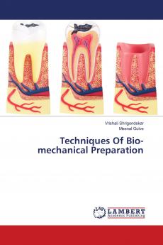 Techniques Of Bio-mechanical Preparation