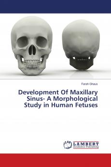 Development Of Maxillary Sinus- A Morphological Study in Human Fetuses