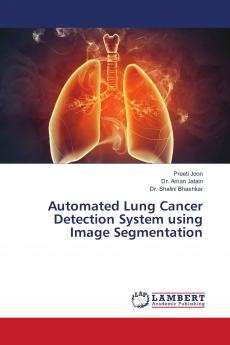 Automated Lung Cancer Detection System using Image Segmentation
