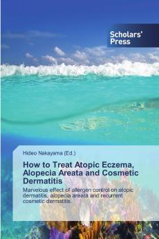 How to Treat Atopic Eczema, Alopecia Areata and Cosmetic Dermatitis