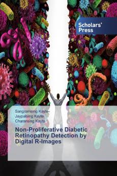 Non-Proliferative Diabetic Retinopathy Detection by Digital R-Images