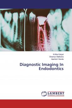 Diagnostic Imaging In Endodontics