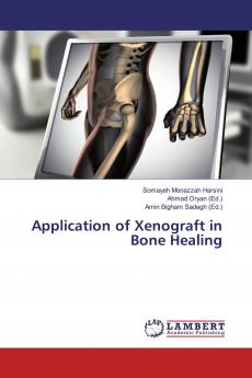 Application of Xenograft in Bone Healing
