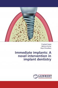 Immediate implants: A novel intervention in implant dentistry