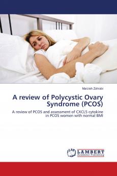 A review of Polycystic Ovary Syndrome (PCOS)