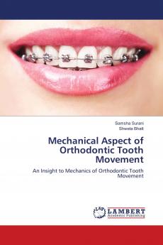 Mechanical Aspect of Orthodontic Tooth Movement