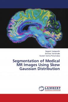 Segmentation of Medical MR Images Using Skew Gaussian Distribution