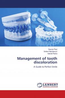 Management of tooth discoloration