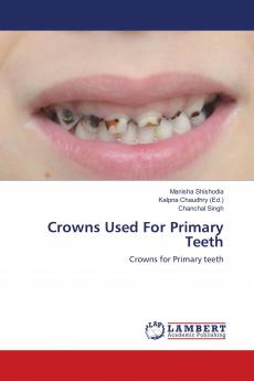 Crowns Used For Primary Teeth