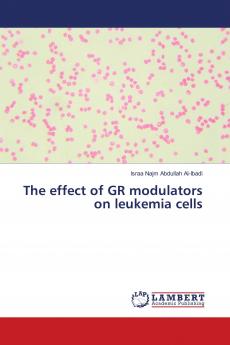 The effect of GR modulators on leukemia cells
