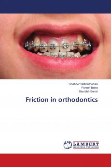 Friction in orthodontics