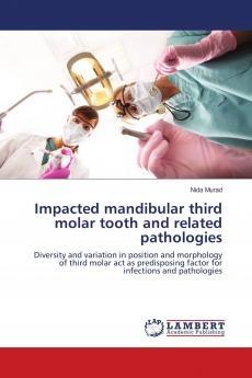 Impacted mandibular third molar tooth and related pathologies