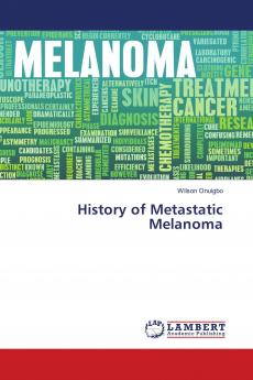 History of Metastatic Melanoma
