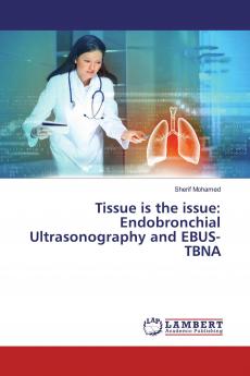 Tissue is the issue: Endobronchial Ultrasonography and EBUS-TBNA