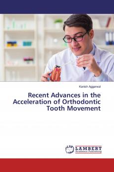 Recent Advances in the Acceleration of Orthodontic Tooth Movement