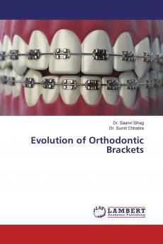 Evolution of Orthodontic Brackets