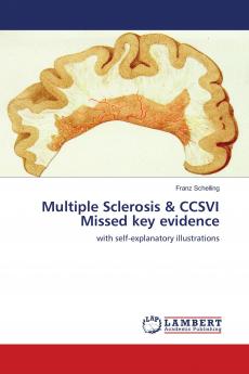 Multiple Sclerosis & CCSVI Missed key evidence