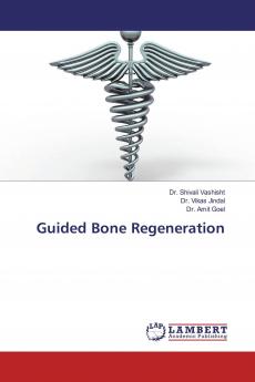 Guided Bone Regeneration
