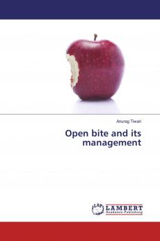 Open bite and its management