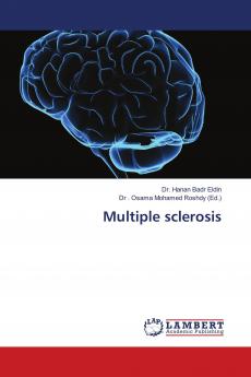 Multiple sclerosis