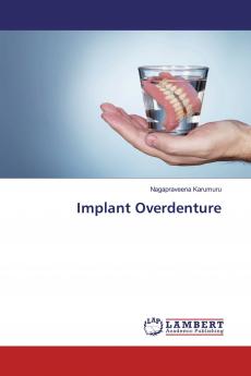 Implant Overdenture