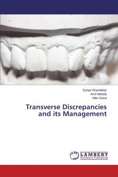 Transverse Discrepancies and its Management