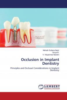 Occlusion in Implant Dentistry