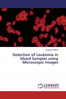 Detection of Leukemia in blood Samples using Microscopic Images