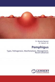 Pemphigus