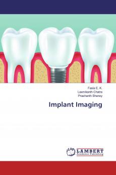 Implant Imaging