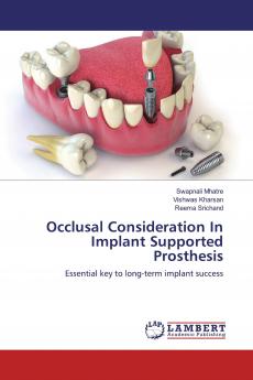 Occlusal Consideration In Implant Supported Prosthesis