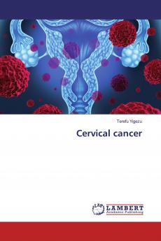 Cervical cancer