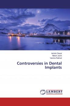 Controversies in Dental Implants