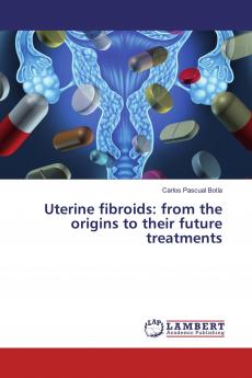 Uterine fibroids: from the origins to their future treatments