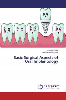 Basic Surgical Aspects of Oral Implantology