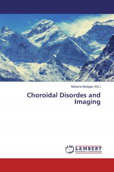 Choroidal Disordes and Imaging