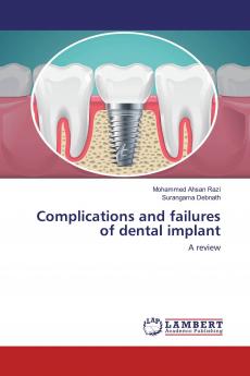 Complications and failures of dental implant