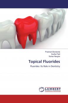Topical Fluorides