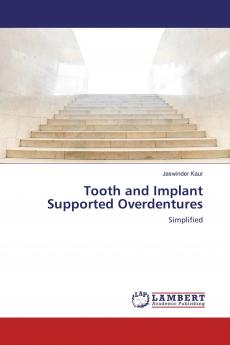 Tooth and Implant Supported Overdentures