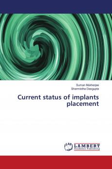 Current status of implants placement