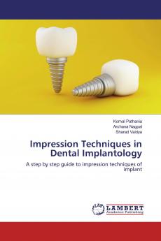 Impression Techniques in Dental Implantology