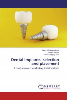Dental implants