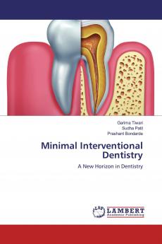 Minimal Interventional Dentistry