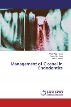 Management of C canal in Endodontics