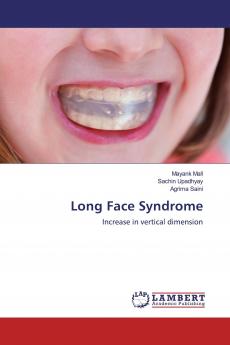 Long Face Syndrome
