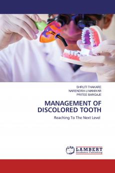 MANAGEMENT OF DISCOLORED TOOTH