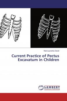 Current Practice of Pectus Excavatum in Children
