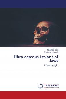 Fibro-osseous Lesions of Jaws