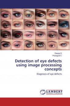 Detection of eye defects using image processing concepts