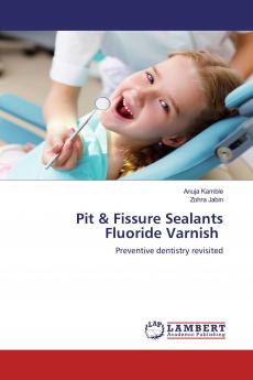 Pit & Fissure SealantsFluoride Varnish